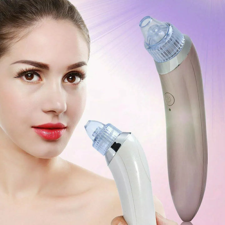 Blackhead Remover Vacuum Acne Cleaner – Deep Pore Cleansing for Flawless Skin